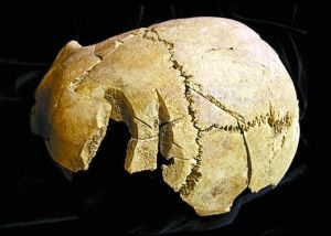 　在牛津大学地下发现的这些遗骨头部有撞击形成的裂痕。