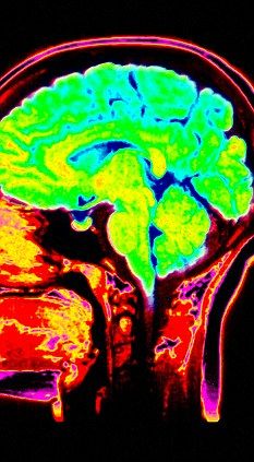 首先，怀疑是情感。志愿者同磁共振成象(MRI)扫面仪相连，他们脑中处理恐惧的区域表现得很活跃。