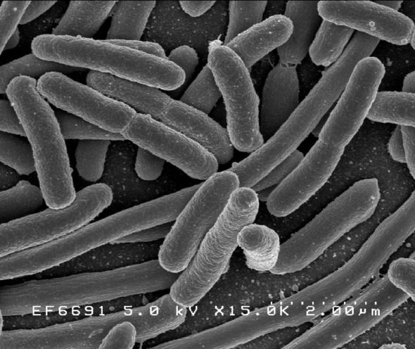 大肠杆菌,一种顽强的生命体.它将会是合适的火星殖民者吗?