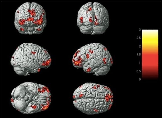 ԴŹ(fMRI)񾭿ѧʮҪ