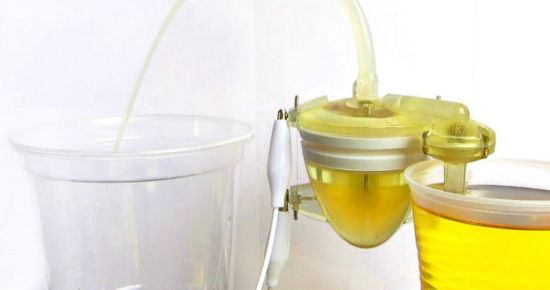 英国的研究人员近期设计了一种使用尿液为动力的类似心脏的机器泵。未来这项技术将有望被应用于一系列环境友好型的机器人设计之中