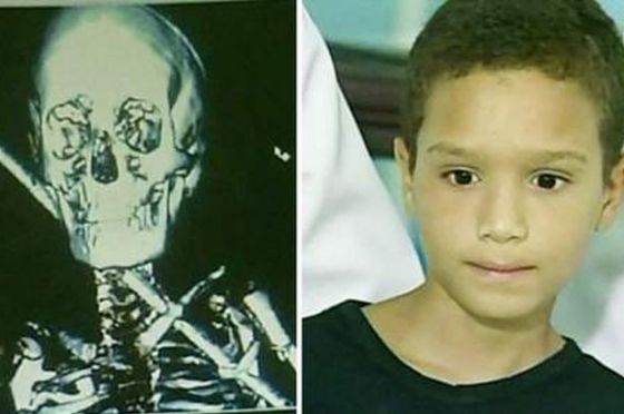 �����˵�10���ͯ