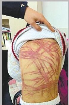 被虐男童返回南京准备上学
