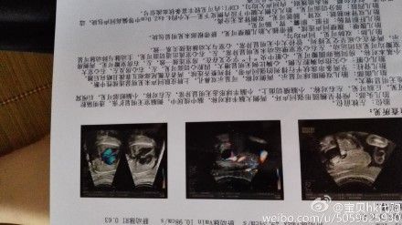 北京和睦家医院李小璐_和睦家医院 医生收入