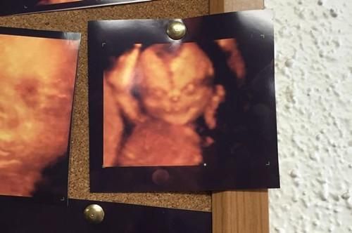 艾伦原本想带着老婆尝试4D超音波技术，一睹未出世的宝宝可爱的照片，但却在等候室看到这张恶魔宝宝照，让他打消了念头。