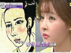 韩国美女追求不同 整容成漫画式肉脸