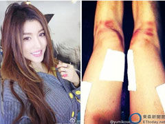 By2妹晒照不慎露底裤