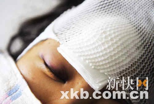 美的电磁炉爆炸致女白领身受重伤(图)