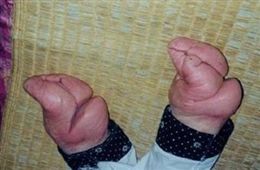 �Ŵ���ŮѪ���������ʷ
