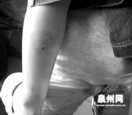 哈巴狗生小狗 两天内伤四人_新闻中心_新浪网