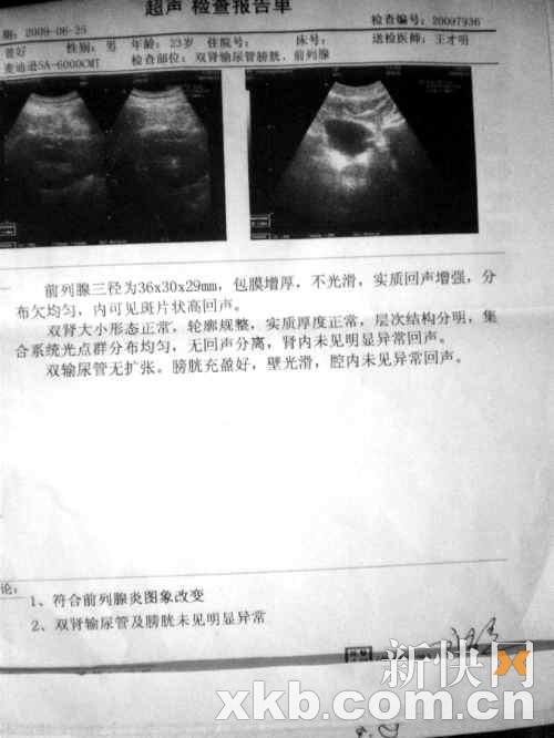 某专科医院的b超结果显示小曾的前列腺符合炎症改变图像.