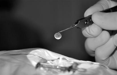 眼角膜是怎么捐献的 1260658343_UNOqz9.jpg