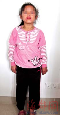 17岁少女长得像7岁小孩_新闻中心_新浪网