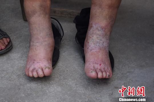 毒气战受害老人:谁敢惦记中国领土就先看看万家岭!