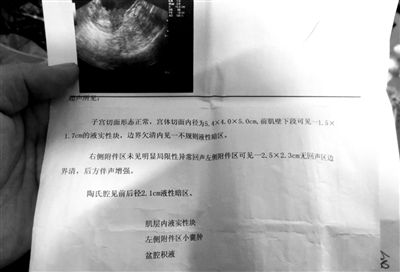 �����ɷ������չʾ��������ǰ��챨�档�����˹�ͼ