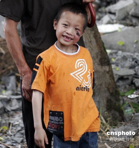 图文:小男孩的脸在地震中受伤