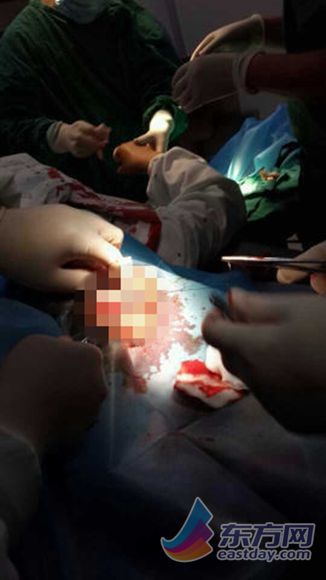  上海 第五人民医院 发生 伤医 事件 