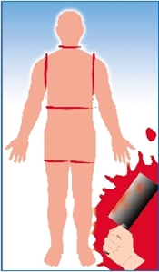 澳门寻获碎尸疑为香港黑道人物 将验DNA(组图