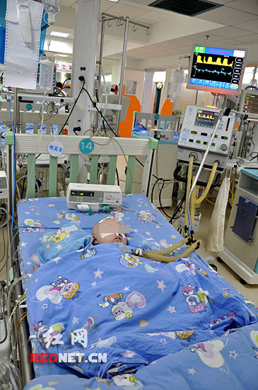 的婴儿木木(化名)因汞中毒已连续昏迷30多个小时,至今仍需呼吸机维持