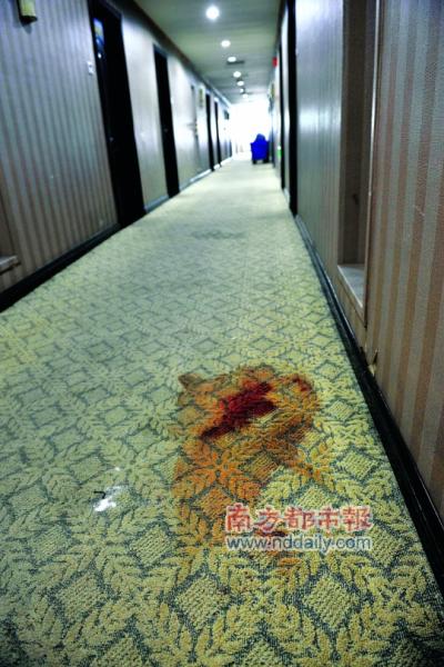 两女宾馆内被捆手脚 一死一伤