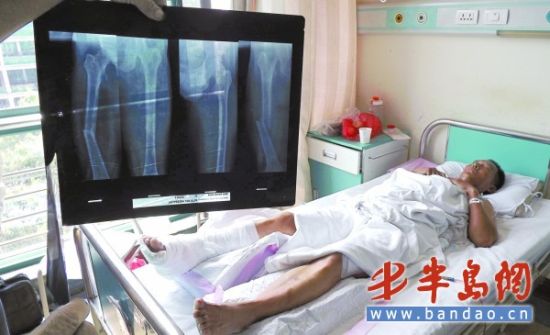 男子装车出意外千斤玻璃砸断腿 包工头表示担责