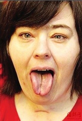 祸转福咳出个肿瘤癌症自愈