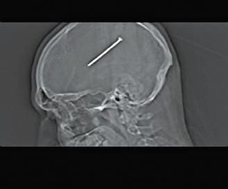 ��������ͷ������һ��������Ȼ�����Գ�"�漣"