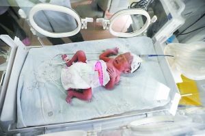 ����̥����Ҫ���ˣ������˵���8500Ԫ