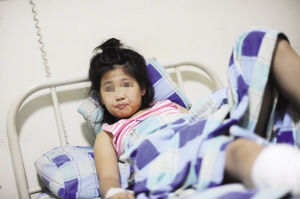 扶梯运行会弹性错动