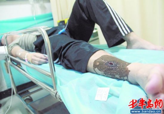 ���ѧ����ɽʵϰ����ҧ��������������ʱ��ҽ