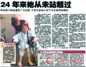 “从未站起过的女孩”昨手术