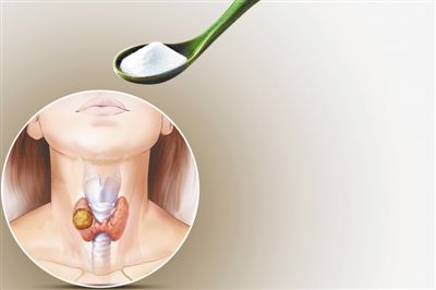 九成以上甲状腺结节并非甲状腺癌(2)
