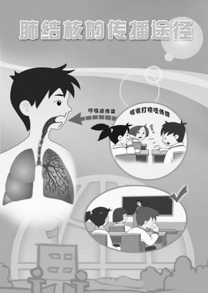 结核病症状消失　不等于病情痊愈