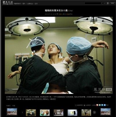 最近<em>东莞打工妹</em>隆胸的新闻热遍网络