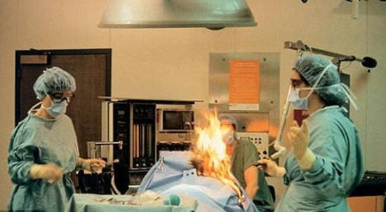 挪威医生给病人做手术时意外点燃酒精 病人三