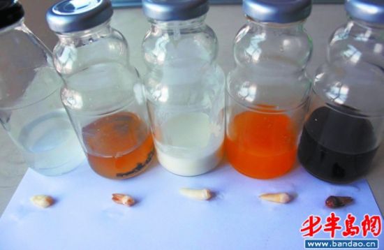 喝啥饮料最伤牙 实验证实可乐损伤牙釉质(图)