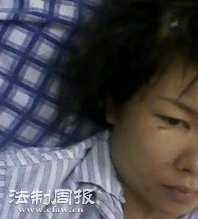 高龄孕妇麦当劳用餐时被砸伤导致引产(组图)