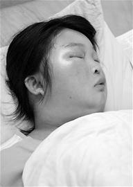 少女身中无名毒致脸庞肿胀头大如斗(图)