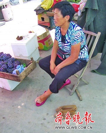 疯狗菜市发狂咬伤多人民警用催泪瓦斯将其制服