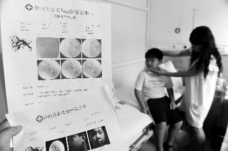 教官掌掴男孩致其鼓膜穿孔给家长短信称其平安