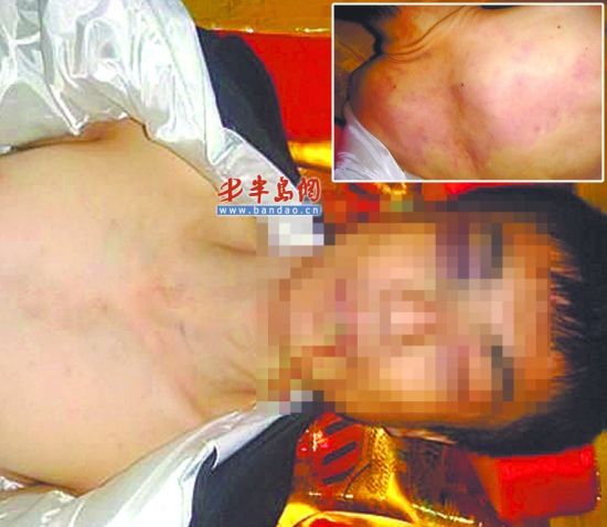 网帖显示死者身上伤痕累累
