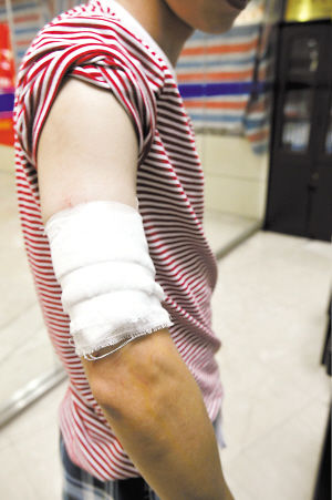 金先生手臂上包扎的伤口.见习记者 崔引 摄