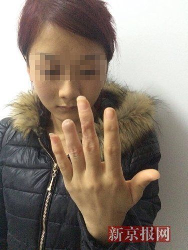 庆阳警方表示,经法医鉴定,杨丽花为轻伤二级。家属供图 庆阳警方表示,经法医鉴定,杨丽花为轻伤二级。家属供图