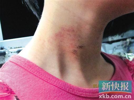 9岁女孩称遭老师勒脖拖行