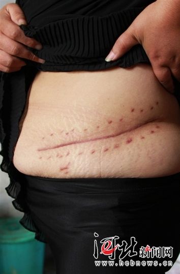 ����׿�������µİ̺ۡ�