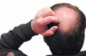 <em>男士</em>毛囊哪种好 鸡皮肤疙瘩毛囊角化牌子同款