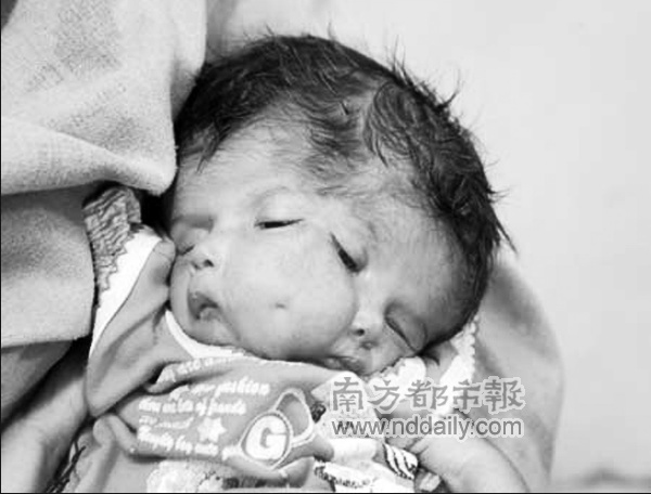 印度双面<em>女婴</em>死亡_新闻中心_新浪网