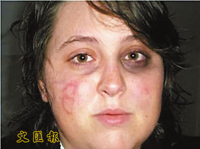 麦凯恩助选员遇袭脸上画字遭质疑(图)