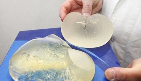 法两公司借PIP劣质硅胶丑闻促销 隆胸假体“买一赠一” - 中文国际_新闻中心_新浪网