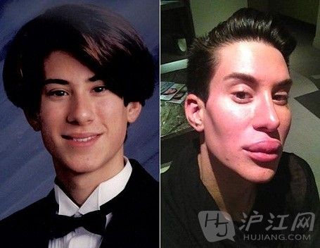 ���Ϊ��˹͡����ǰ����Ƭ